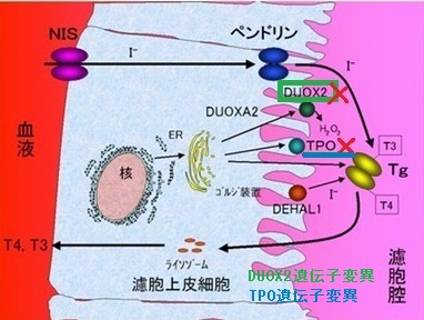 DUOX2(Dual oxidase 2) or Thyroid oxidase 2（THOX2)遺伝子変異